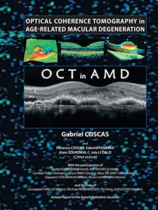 Optical Coherence Tomography In Age-Related Macular Degeneration-..