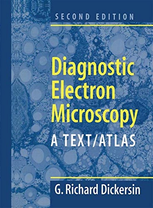 Diagnostic Electron Microscopy: A Text/Atlas-..