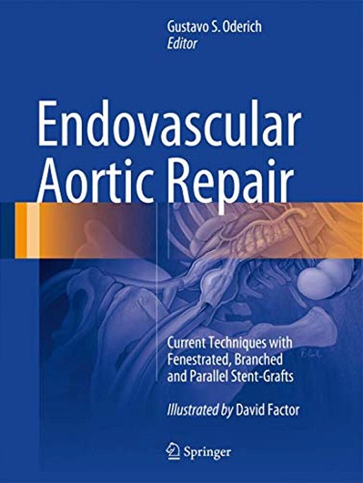 Endovascular Aortic Repair: Current Techniques With Fenestrated, Branched And Parallel Stent-Grafts-..