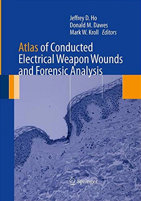 Atlas Of Conducted Electrical Weapon Wounds And Forensic Analysis-..