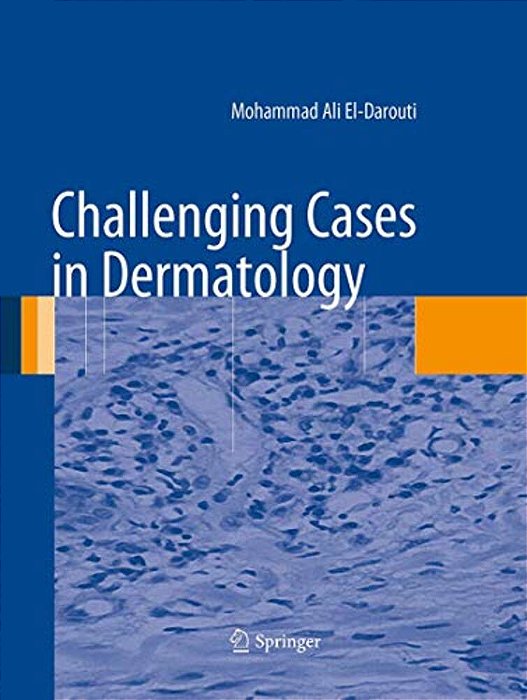 Challenging Cases In Dermatology-..