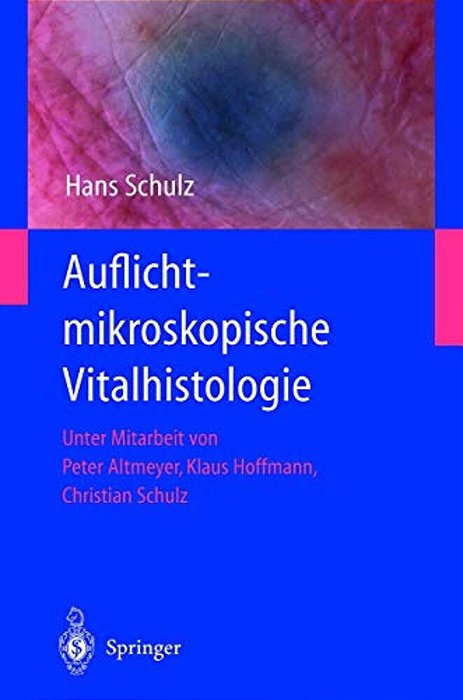 Auflichtmikroskopische Vitalhistologie: Dermatologischer Leitfaden-..
