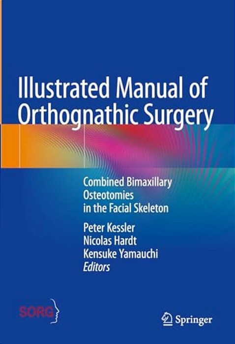 Illustrated Manual Of Orthognathic Surgery: Combined Bimaxillary Osteotomies In The Facial Skeleton-..
