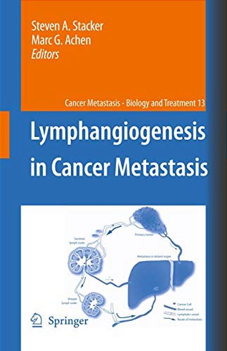 Lymphangiogenesis In Cancer Metastasis-..