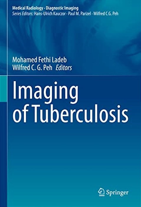Imaging Of Tuberculosis-..