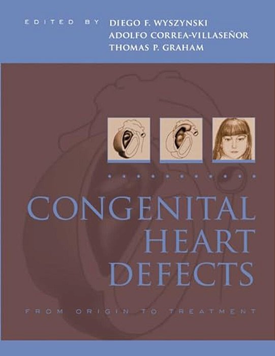 Congenital Heart Defects: From Origin To Treatment-..