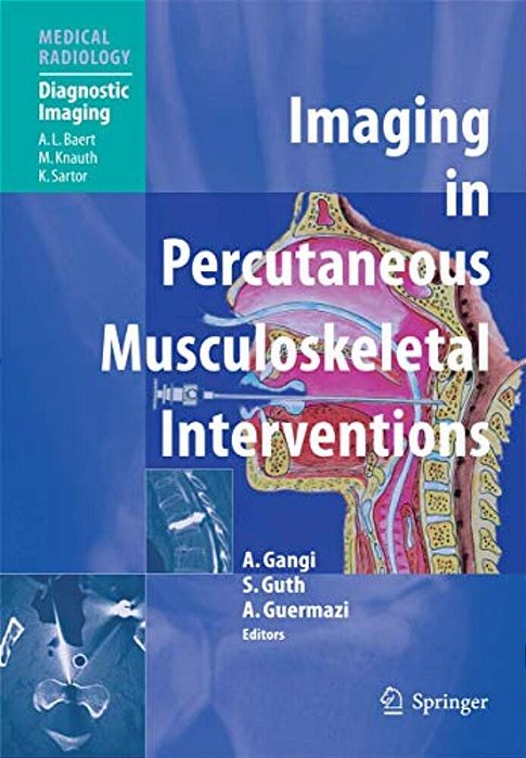 Imaging In Percutaneous Musculoskeletal Interventions-..