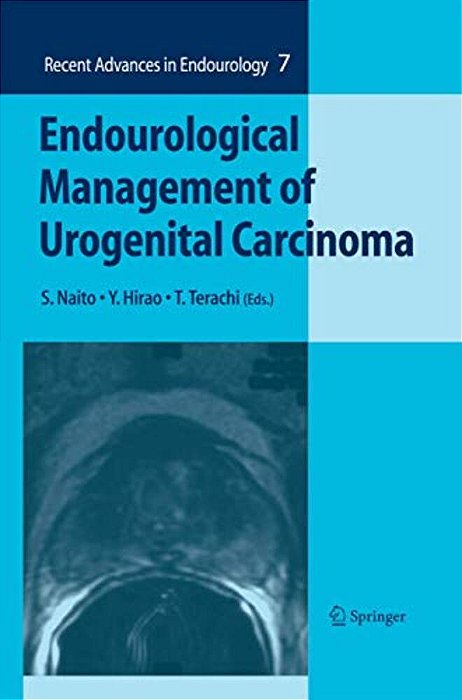Endourological Management Of Urogenital Carcinoma-..
