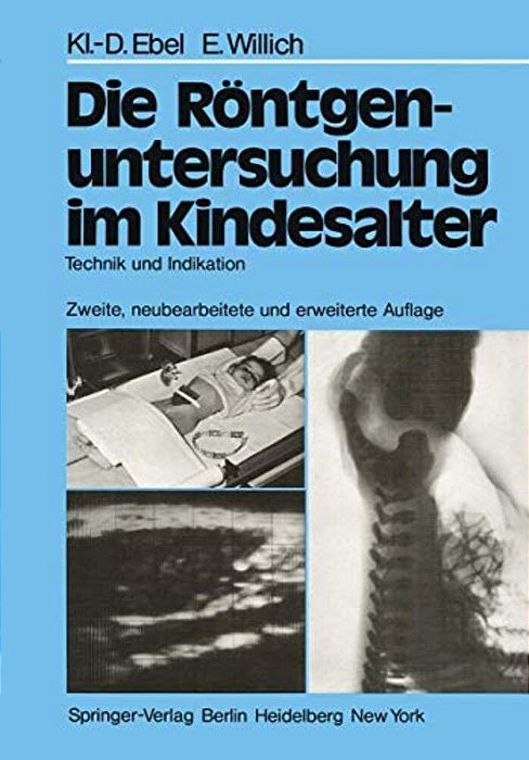Die Röntgenuntersuchung Im Kindesalter: Technik Und Indikation-..