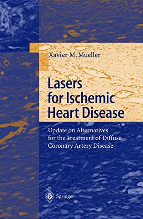 Lasers For Ischemic Heart Disease: Update On Alternatives For The Treatment Of Diffuse Coronary Artery Disease-..