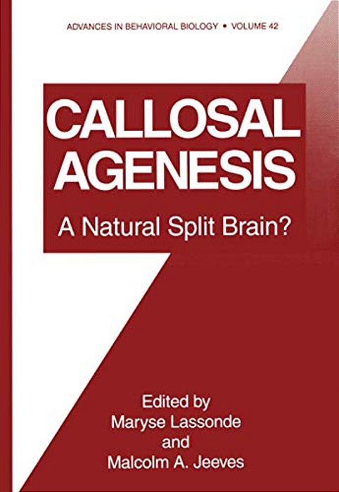 Callosal Agenesis: A Natural Split Brain?-..
