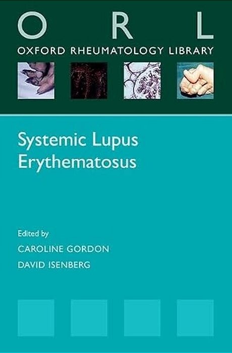 Systemic Lupus Erythematosus-..