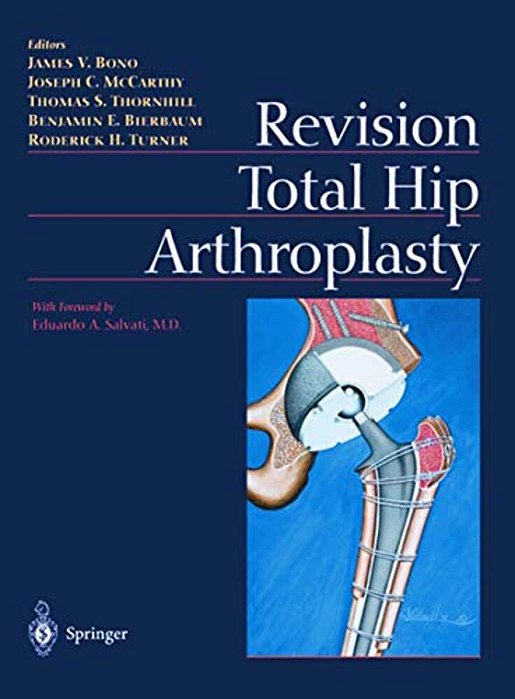 Revision Total Hip Arthroplasty-..