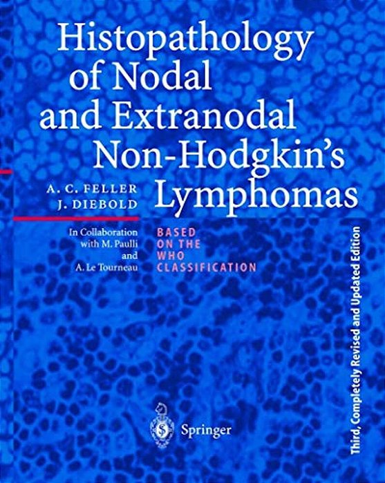 Histopathology Of Nodal And Extranodal Non-Hodgkin's Lymphomas-..