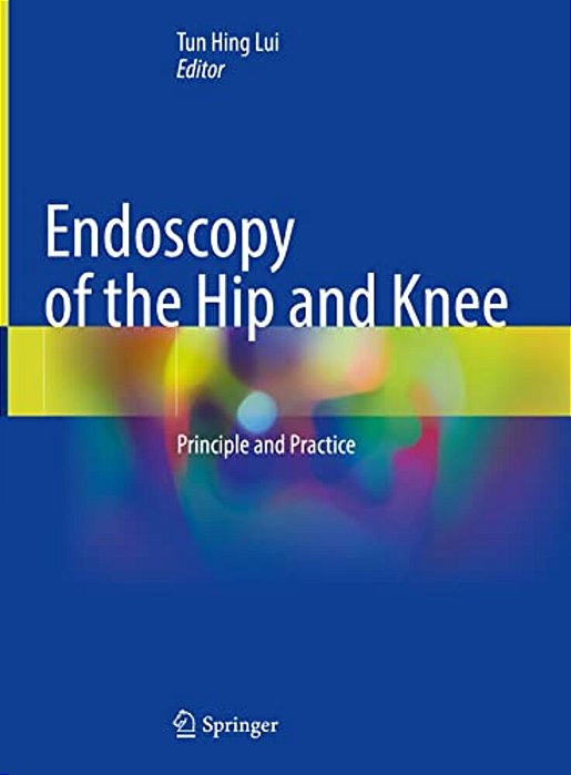 Endoscopy Of The Hip And Knee: Principle And Practice-..