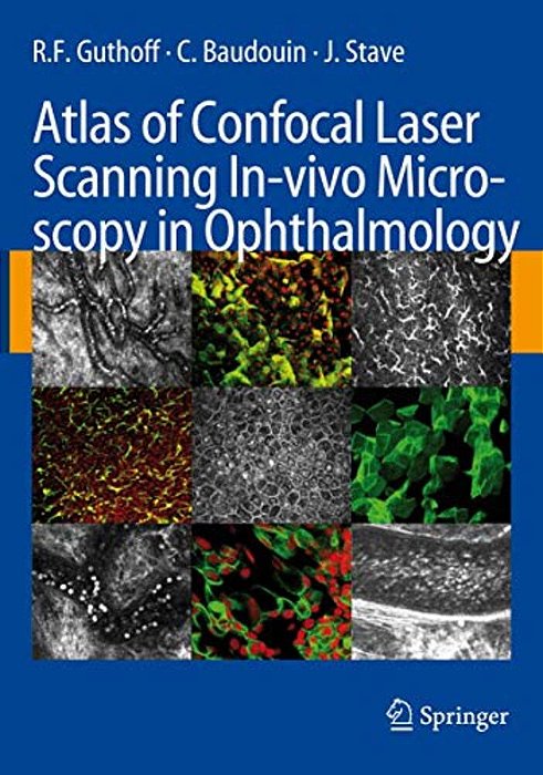 Atlas Of Confocal Laser Scanning In-Vivo Microscopy In Ophthalmology: Principles And Applications In Diagnostic And Therapeutic Ophtalmology-..