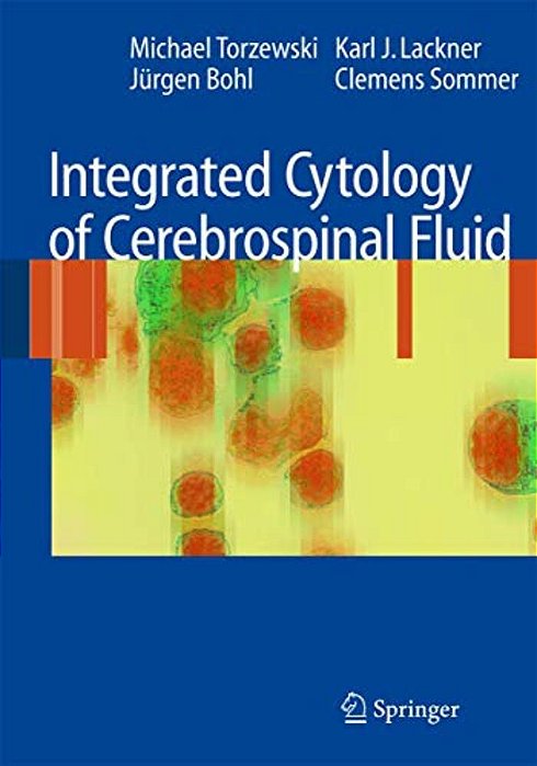 Integrated Cytology Of Cerebrospinal Fluid-..