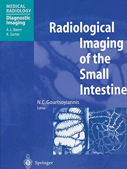 Radiological Imaging Of The Small Intestine-..