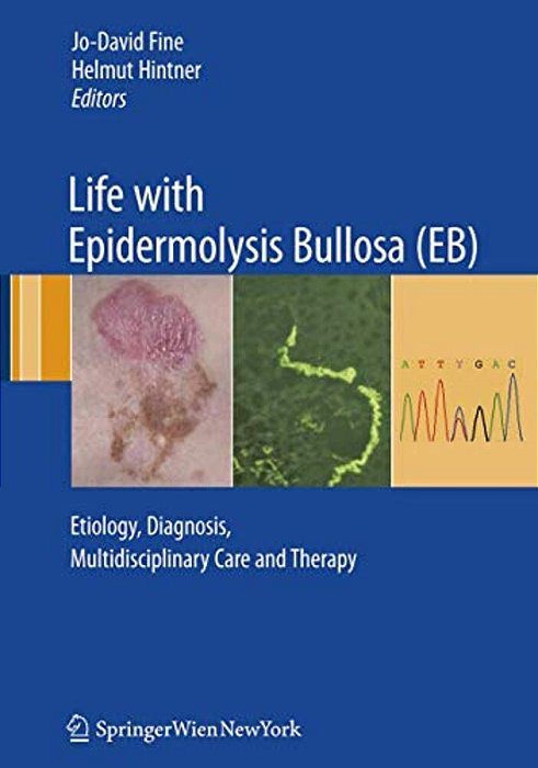 Life With Epidermolysis Bullosa (Eb): Etiology, Diagnosis, Multidisciplinary Care And Therapy-..