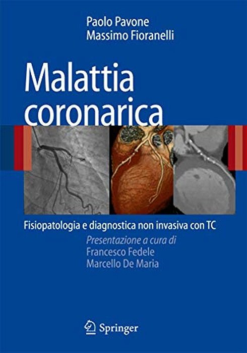 Malattia Coronarica: Fisiopatologia E Diagnostica Non Invasiva Con Tc-..