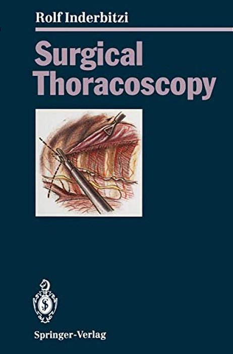 Surgical Thoracoscopy-..