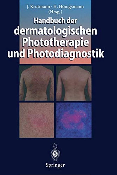 Handbuch Der Dermatologischen Phototherapie Und Photodiagnostik-..