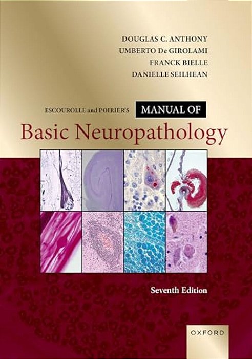 Escourolle And Poirier's Manual Of Basic Neuropathology-..