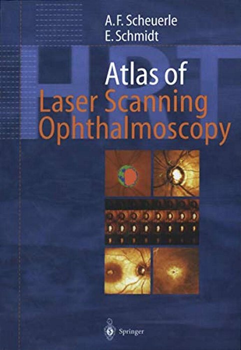 Atlas Of Laser Scanning Ophthalmoscopy-..