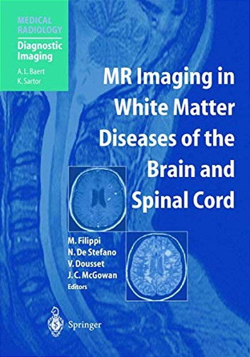 Mr Imaging In White Matter Diseases Of The Brain And Spinal Cord-..