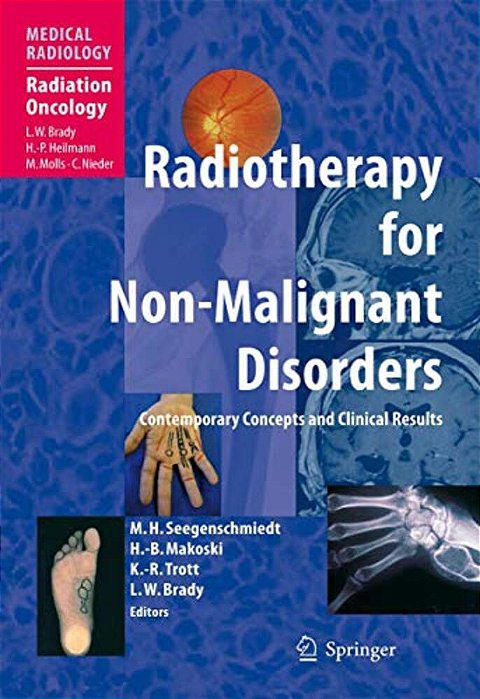 Radiotherapy For Non-Malignant Disorders-..