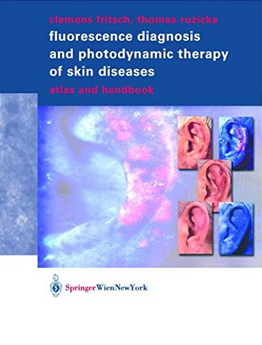 Fluorescence Diagnosis And Photodynamic Therapy Of Skin Diseases: Atlas And Handbook-..