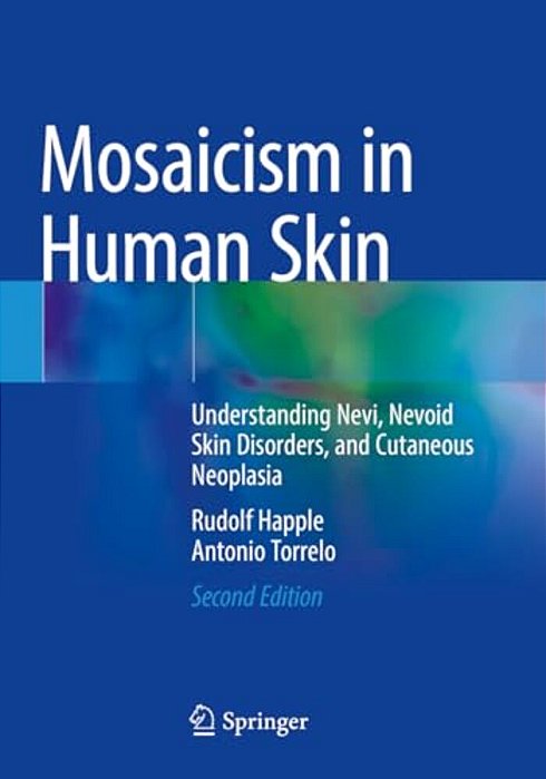 Mosaicism In Human Skin: Understanding Nevi, Nevoid Skin Disorders, And Cutaneous Neoplasia-..