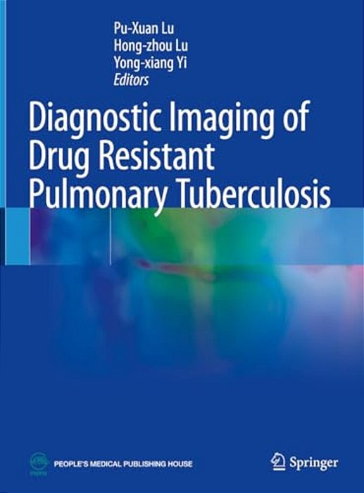 Diagnostic Imaging Of Drug Resistant Pulmonary Tuberculosis-..