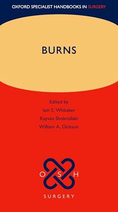 Burns-..