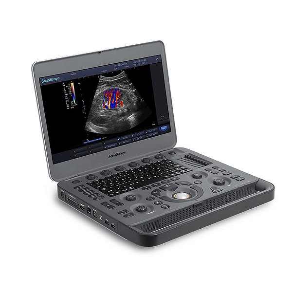 Equipamento de Ultrassom e Elastografia Doppler Colorido Portátil SonoScape X3