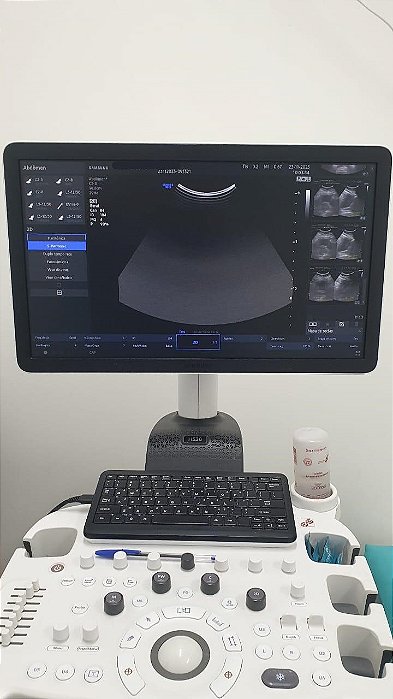 ULTRASSOM SAMSUNG - HS30
