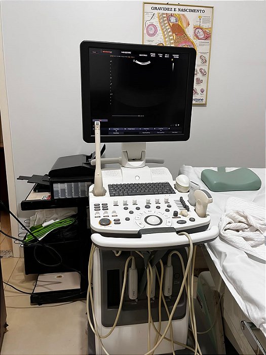 ULTRASSOM SAMSUNG - SONOACE R7