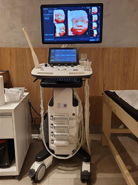 ULTRASSOM SAMSUNG – HS40 3D/4D