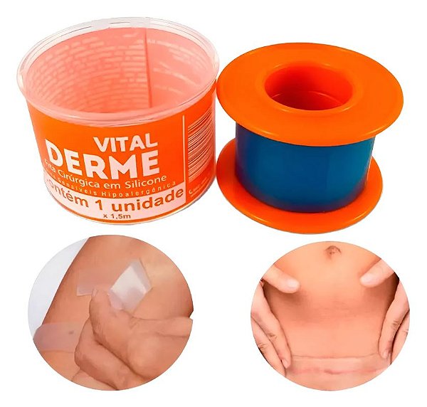 Curativo / Fita Silicone 5Cmx5M - Vitalderme