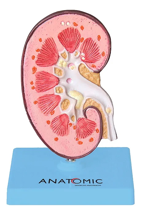 Rim com Patologias