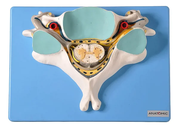 Quinta Vertebra Cervical com Medula Espinhal e Nervos