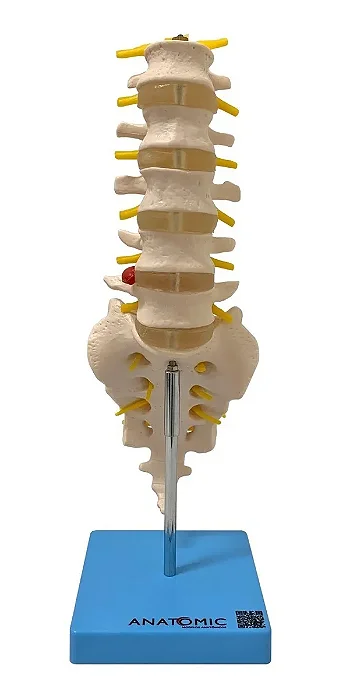 Coluna Vertebral Lombar