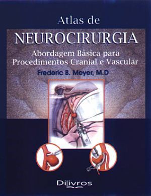 Livro Atlas de Neurocirurgia Meyer