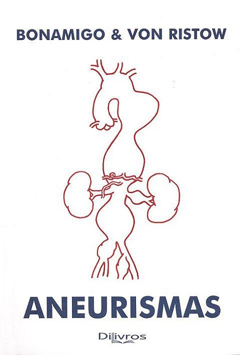 Livro Aneurismas   Bonamigo