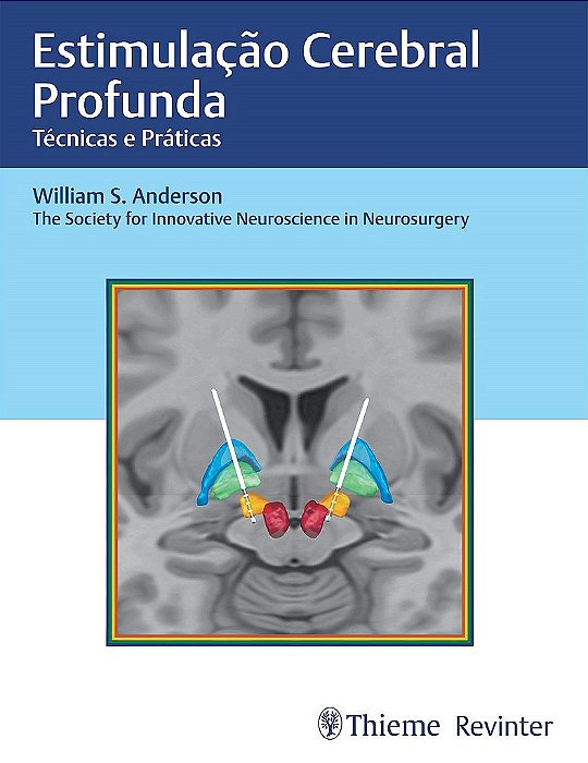 Livro Estimulação Cerebral Profunda