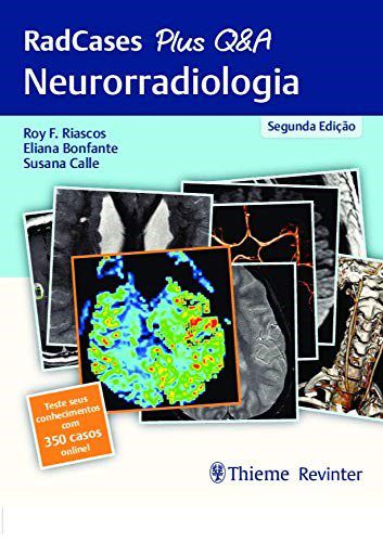 Livro Radcases Plus Q&A Neurorradiologia