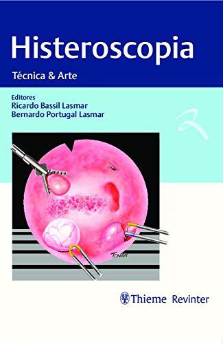 Livro Histeroscopia: Técnica e Arte  Lasmar