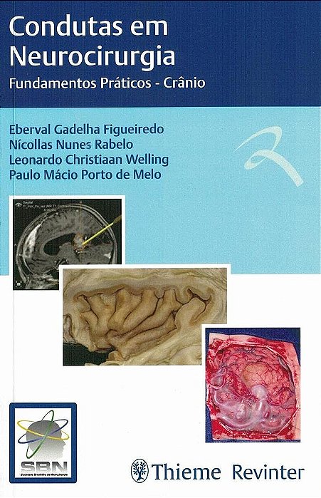 Livro Condutas em Neurocirurgia - Crânio - Figueiredo - Revinter