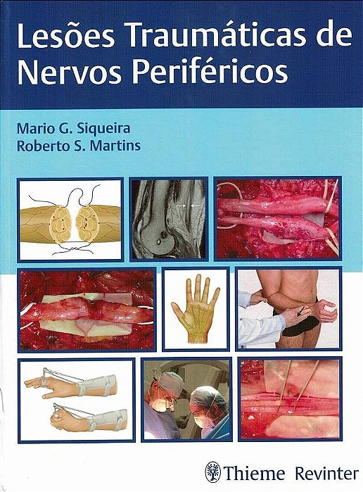 Livro Lesoes Traumaticas de Nervos Perifericos - Siqueira