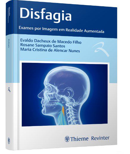 Livro Disfagia Exames por Imagem em Realidade Aumentada - Macedo - Revinter